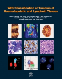 WHO Classification of Tumors of Haematopoietic and Lymphoid Tissues - 2017 Revised Edition